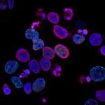 national-cancer-institute-L7en7Lb-Ovc-unsplash